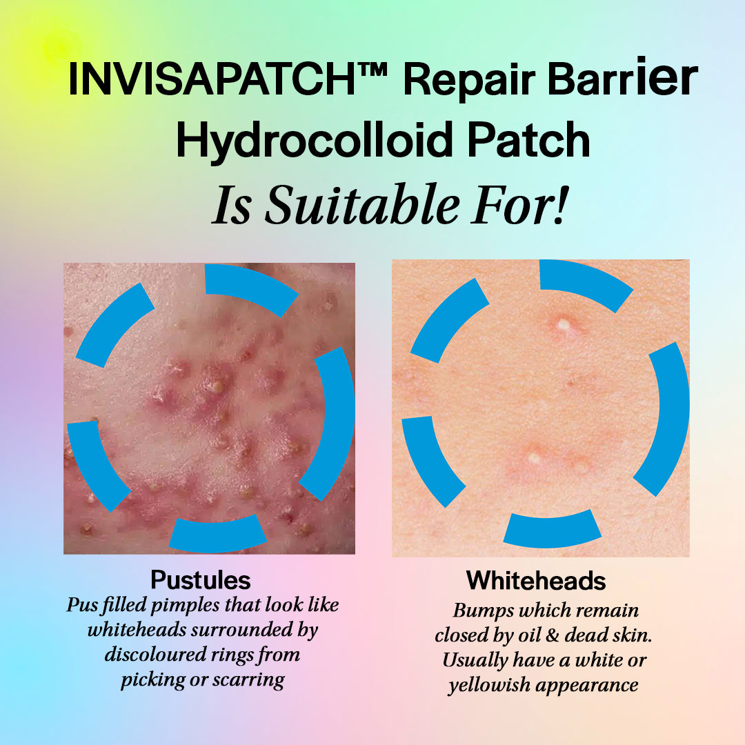 Invisapatch Repair Barrier Hydrocolloid Spot Patch